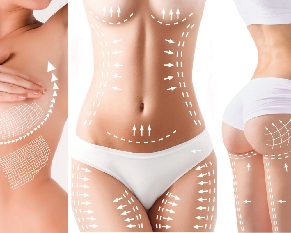 Trattamenti-di-rimodellamento-del-corpo